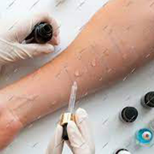 اختبار الحساسية