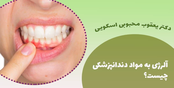 آلرژی به مواد دندانپزشکی چیست؟