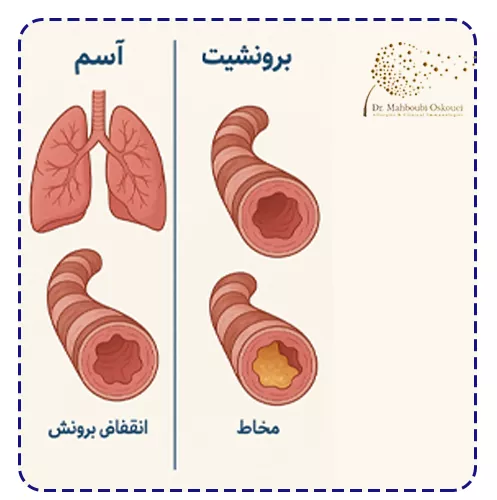 تفاوت آسم و برونشیت در علائم چگونه است؟
